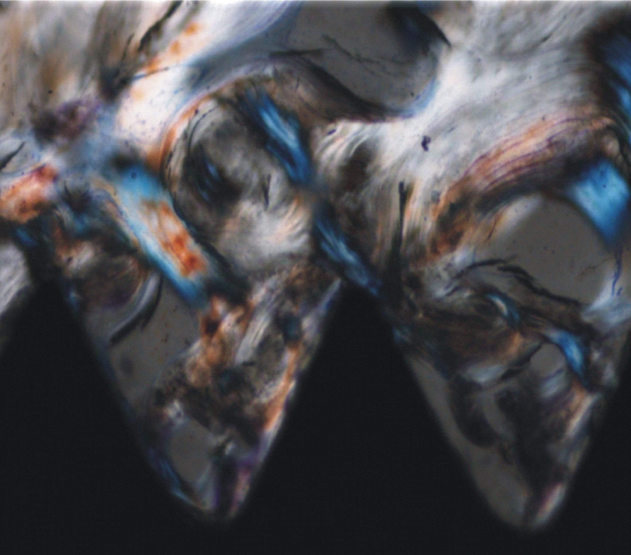 implant_bioloy_light_polarized Vantaggi degli impianti dentali